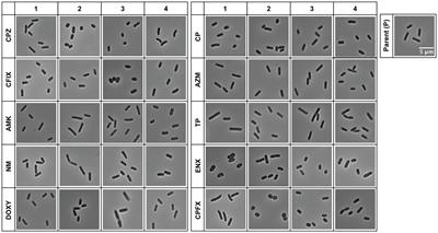 Bioinformatic analysis reveals the association between bacterial morphology and antibiotic resistance using light microscopy with deep learning